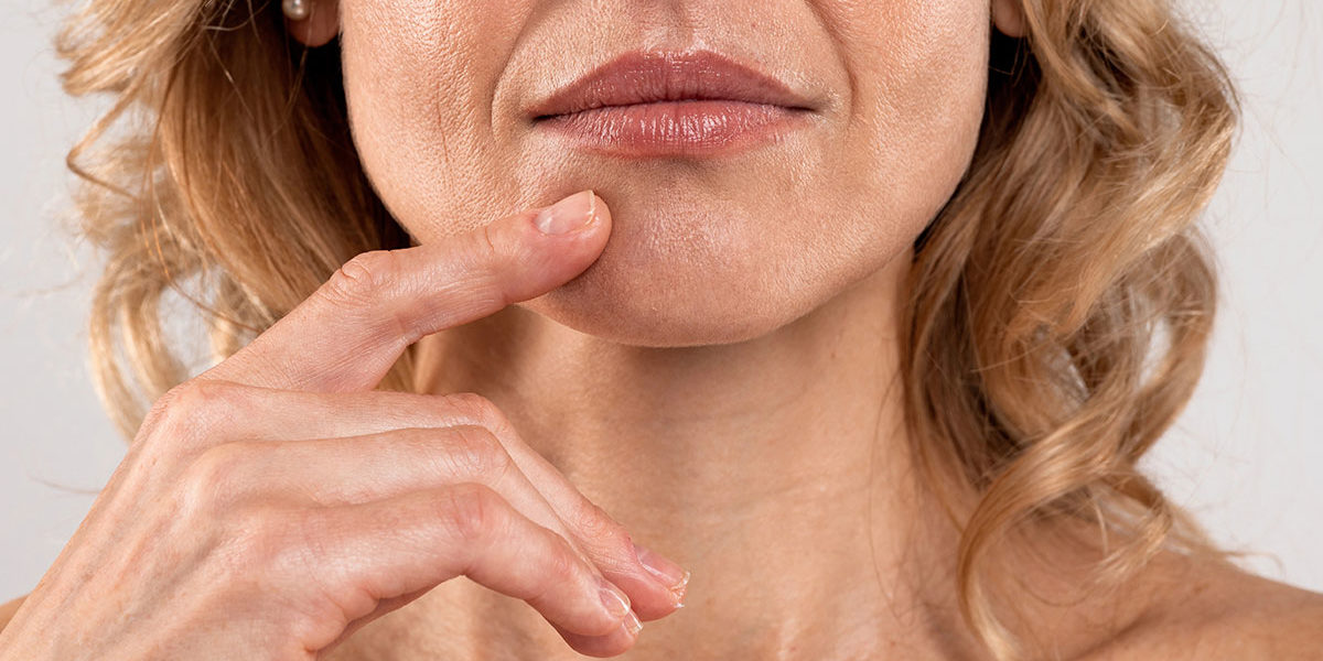 Бръчки около устата Бръчки около устата