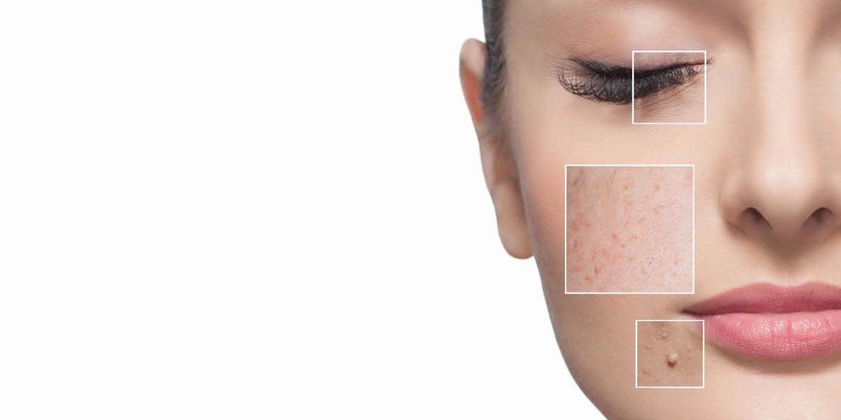 пигментни петна по кожата