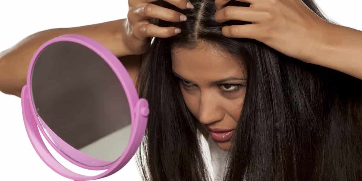 do i have dandruff имам ли пърхот