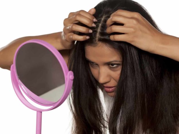 do i have dandruff имам ли пърхот