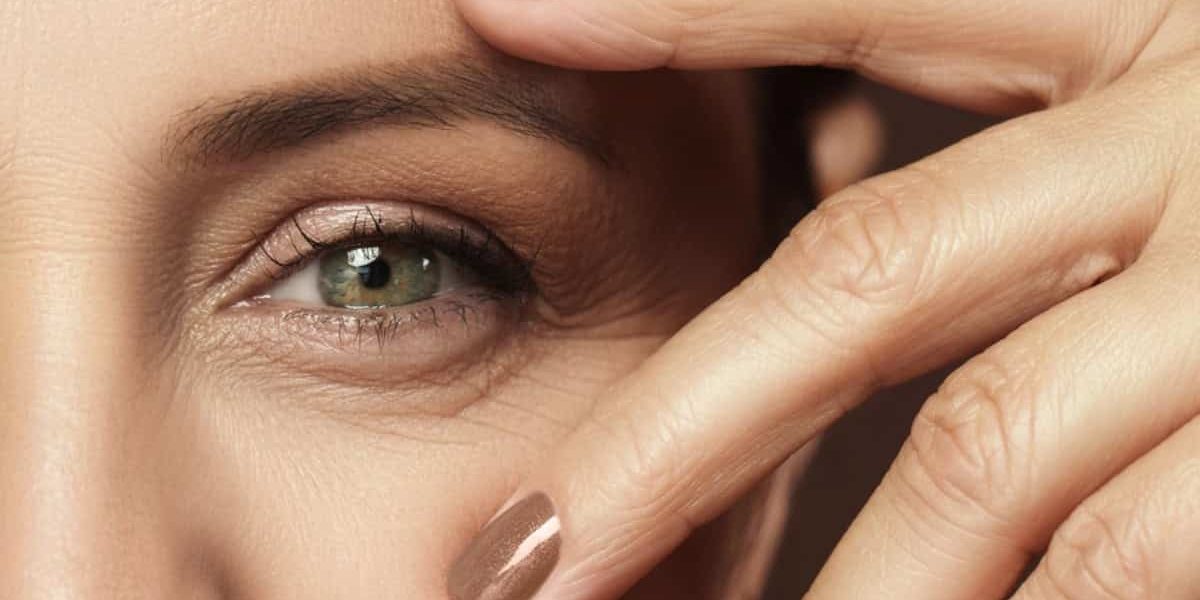 eye wrinkles Бръчки около очите