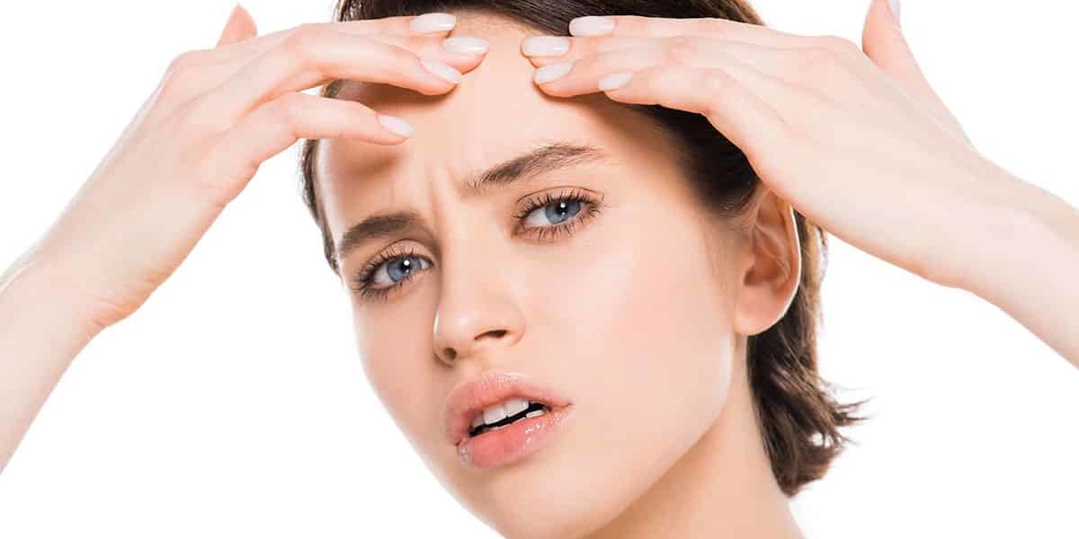 Акне по челото Акне по челото