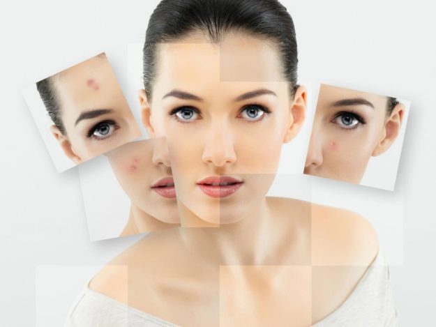 pimple on face пъпки по лицето